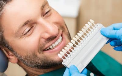 Long-Term Care for Veneers: Tips for Keeping Your Smile Bright in Franklin, TN