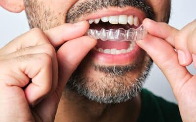 Invisalign: Who Qualifies and What to Expect in Franklin, TN