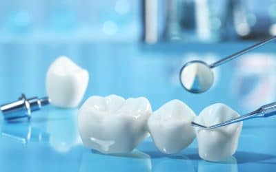 Dental Bridges in Franklin, TN: Closing the Gap in Your Smile